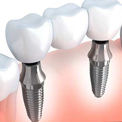 bawa Dental clinic in Chandigarh,